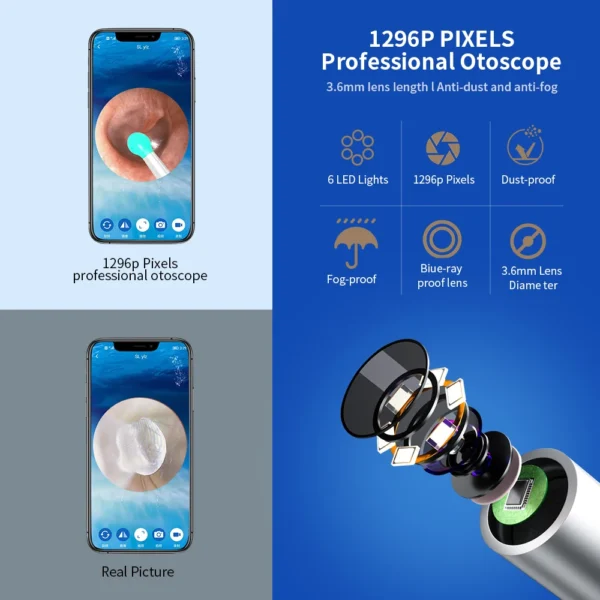 NE3 Wireless Ear Cleaner with Camera, LED, 1080P Otoscope for iPhone & Android - Image 4