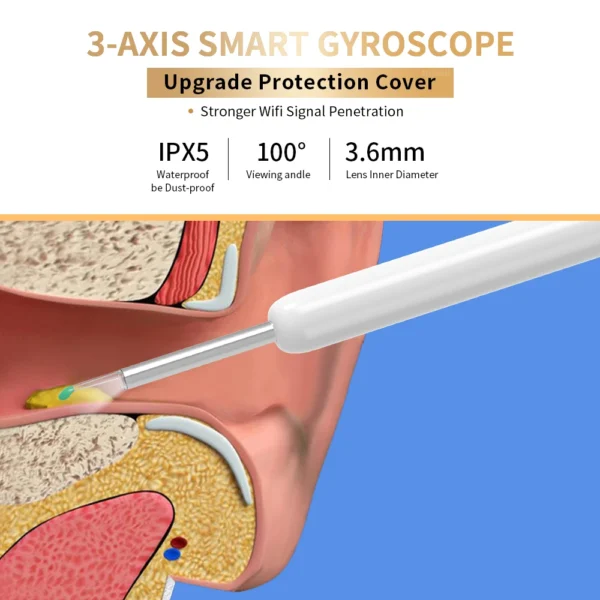 NE3 Wireless Ear Cleaner with Camera, LED, 1080P Otoscope for iPhone & Android - Image 3